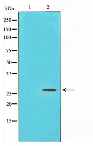 Polyclonal Rabbit anti-Human PDGF-BB Antibody (WB)