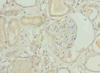 Polyclonal Rabbit anti-Human NICN1 Antibody (IHC, WB)