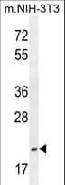 IHC-plus™ TCEAL3 Antibody (aa15-43)