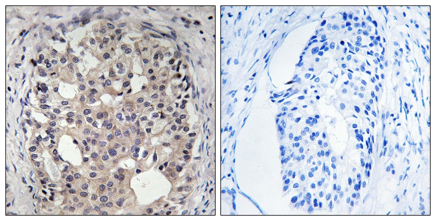 Polyclonal Rabbit anti-Human CDC25A Antibody (phospho-Ser178, IHC, WB)