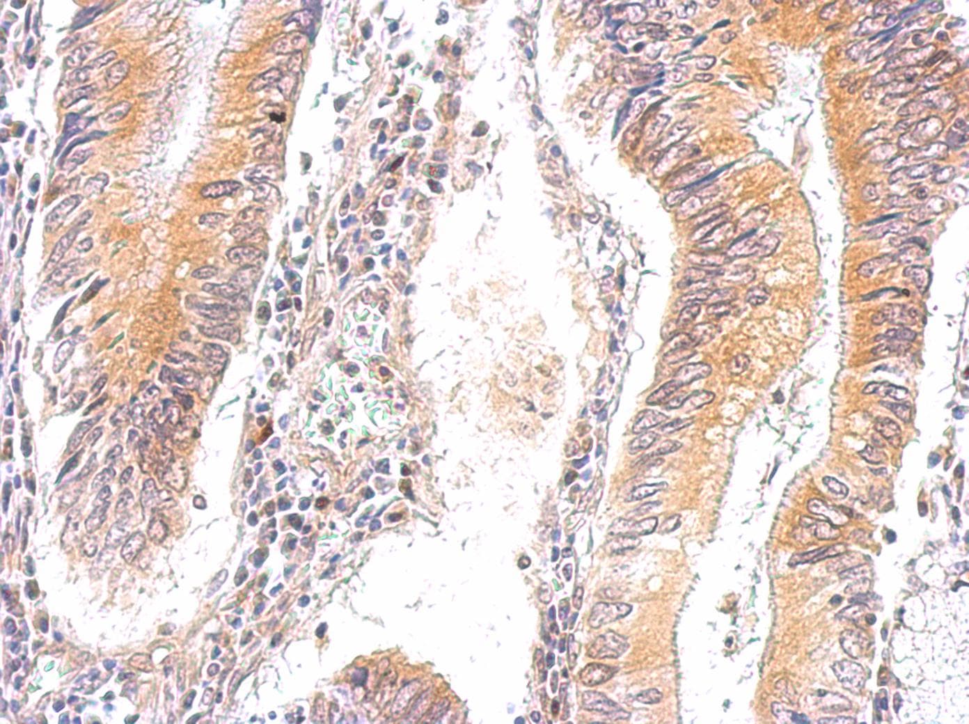 PRKAG2 / AMPK Gamma 2 Antibody (aa192-569)