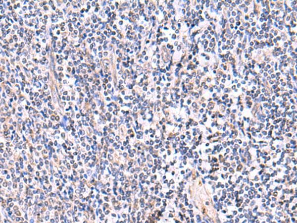 FDFT1 / Squalene Synthase Antibody