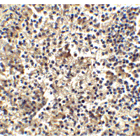 Polyclonal Rabbit anti-Human TLR4 Antibody (IHC, IF, WB)