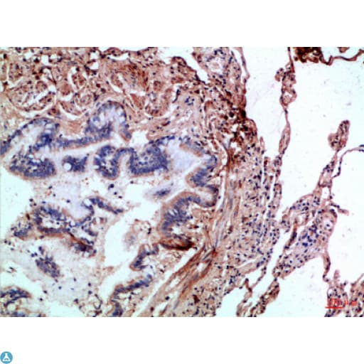 CASP1 / Caspase 1 Antibody