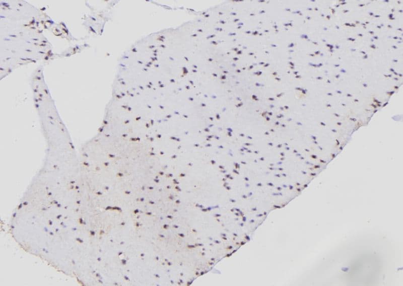 PSMB9 Antibody