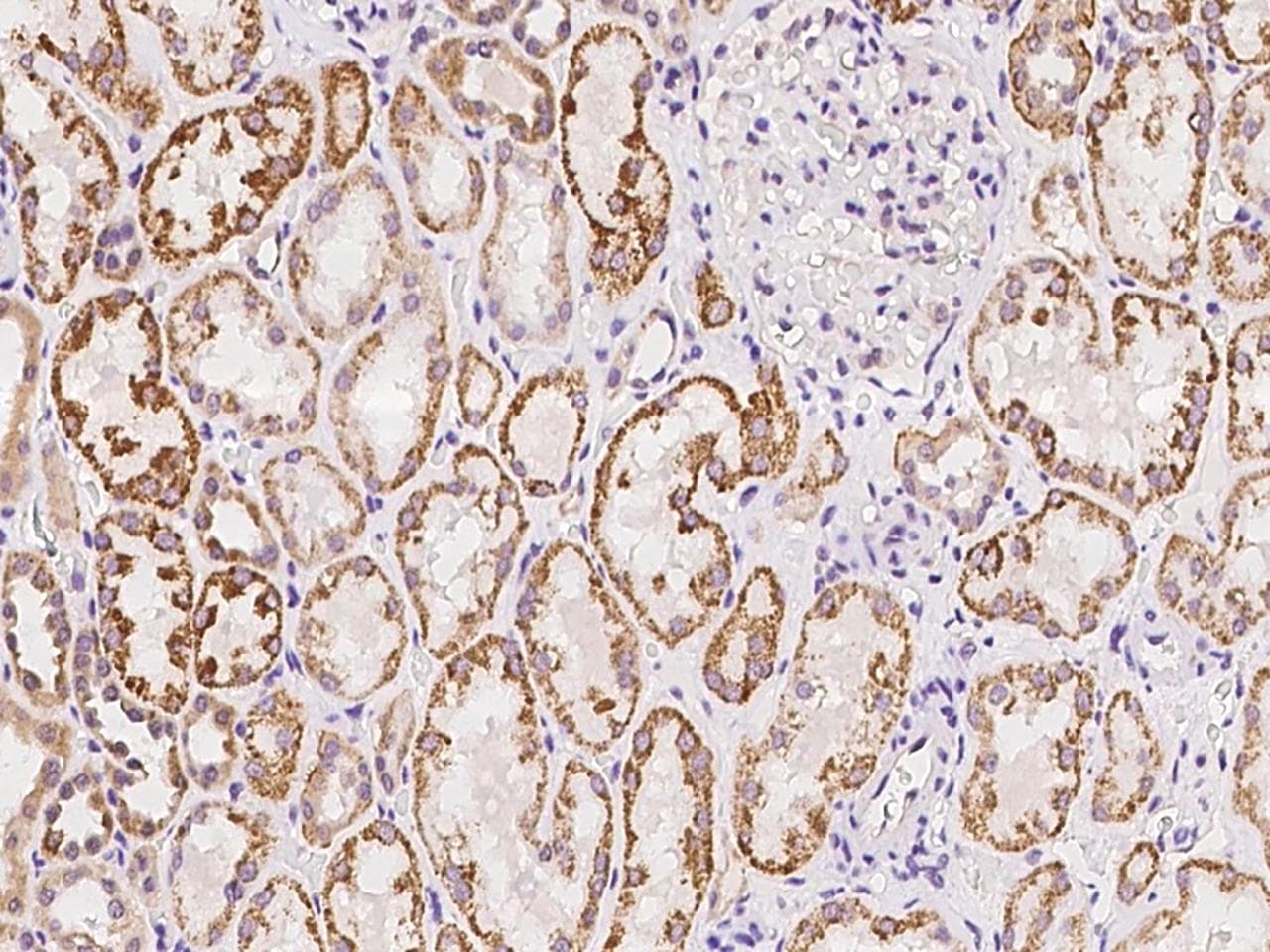 Polyclonal Rabbit anti-Human PCDH17 Antibody (IHC)