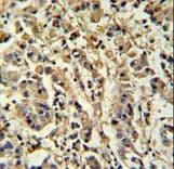 SIRT3 / Sirtuin 3 Antibody (aa304-334)