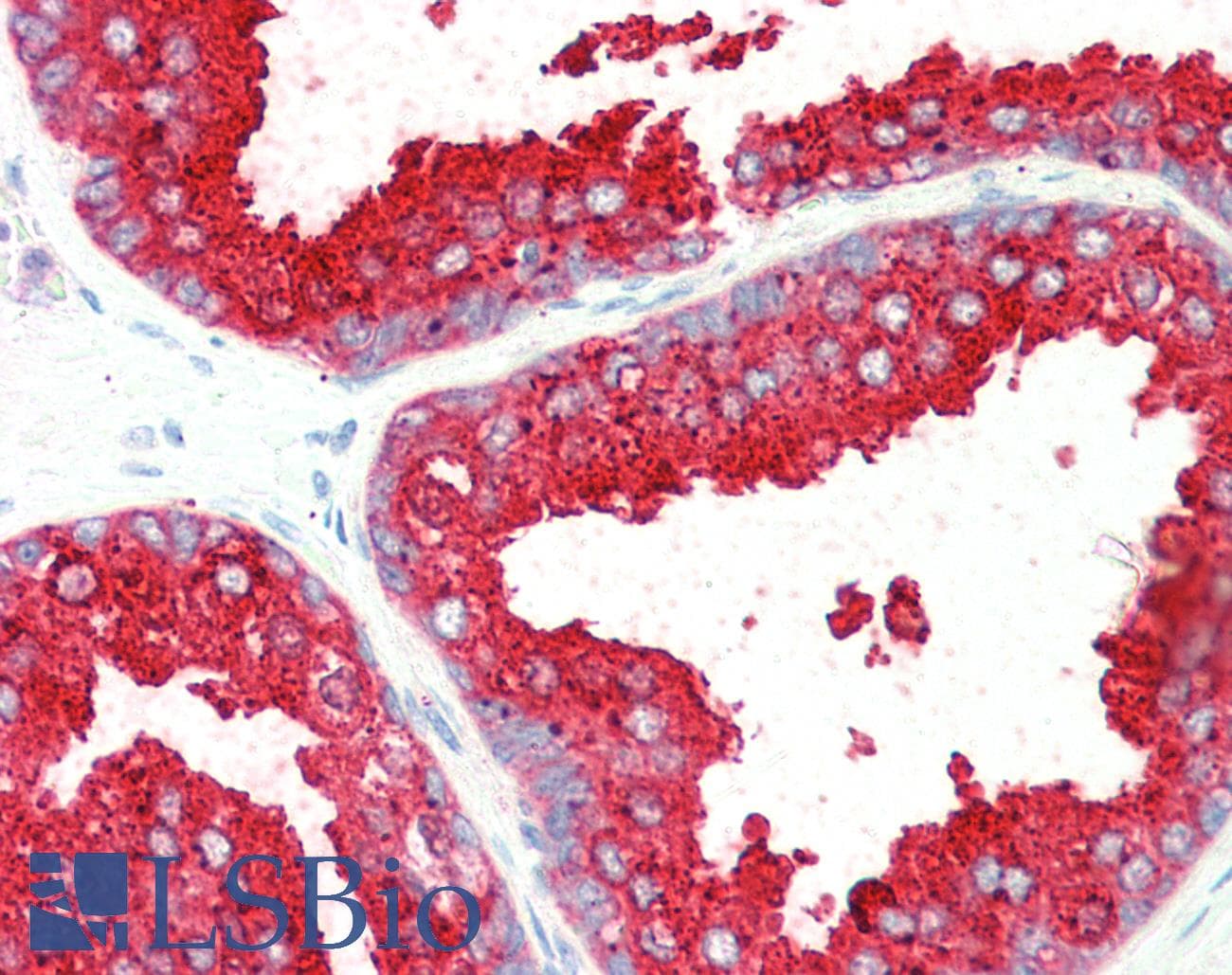 IHC-plus™ Polyclonal Goat anti-Human ELMO3 Antibody (aa760-773, IHC, WB)