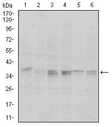PPP1CA / PP1-Alpha Antibody (clone 5000000000)