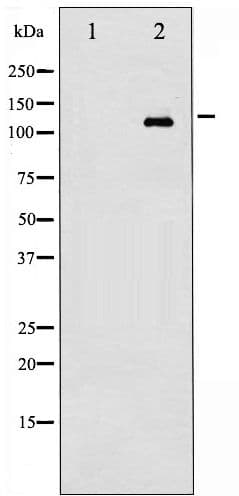 EGFR Antibody (phospho-Ser695)