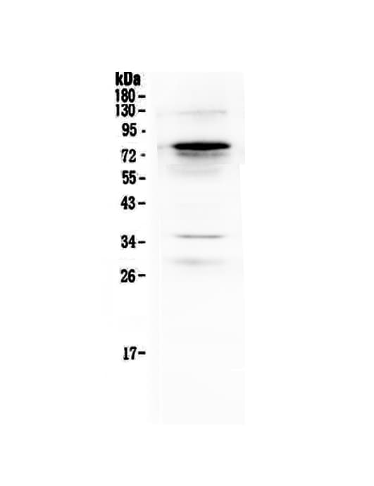 Polyclonal Rabbit anti-Human Complement C9 Antibody (WB)