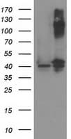Monoclonal Mouse anti-Human PANK3 Antibody (clone OTI3C4, WB)