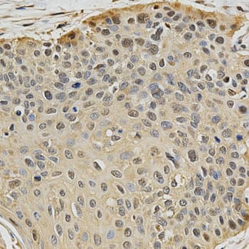 Polyclonal Rabbit anti-Human PSMB9 Antibody (IHC, IF, WB)
