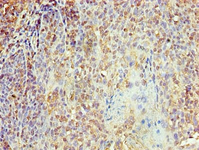 KPNA1 / Importin Alpha 5 Antibody