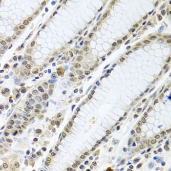 TIA-1 Antibody