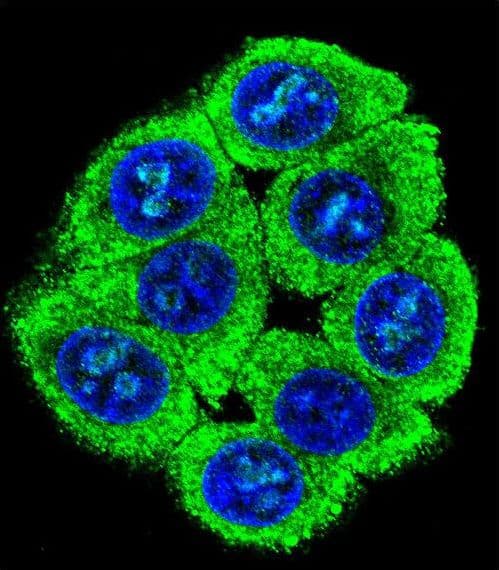 PATL2 Antibody (aa168-196)
