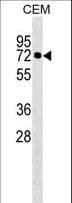 Polyclonal Rabbit anti-Human KLHL28 / BTBD5 Antibody (aa384-411, WB)