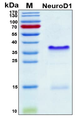 Human NEUROD1 Protein (Recombinant 6His, N-terminus)