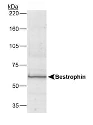 BEST1 / BEST / Bestrophin Antibody