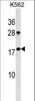 Polyclonal Rabbit anti-Human GKN1 / Gastrokine 1 Antibody (aa124-150, WB)