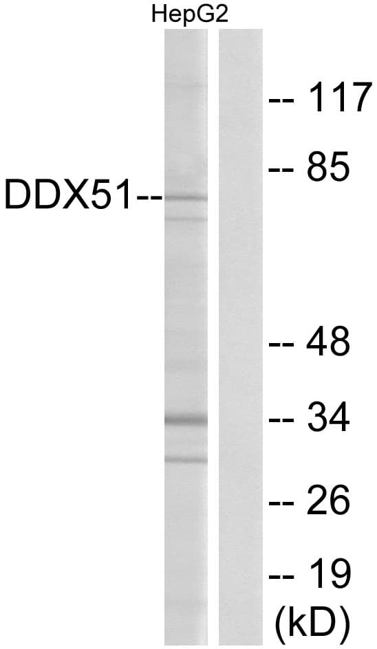 DDX51 Antibody (aa617-666)