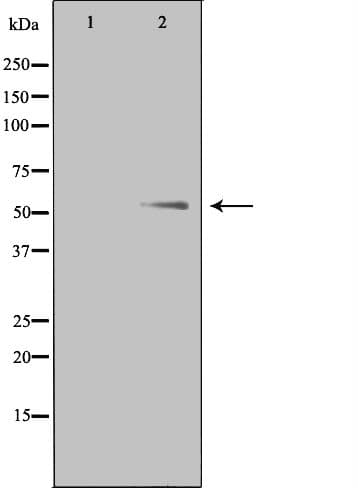 Polyclonal Rabbit anti-Human PTHR / PTHR1 Antibody (IHC, IF, WB)