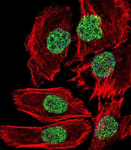 Polyclonal Rabbit anti-Human FOSL2 / FRA-2 Antibody (aa220-248, IF, WB)