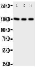 Polyclonal Rabbit anti-Human NTRK3 / TRKC Antibody (aa172-186, WB)