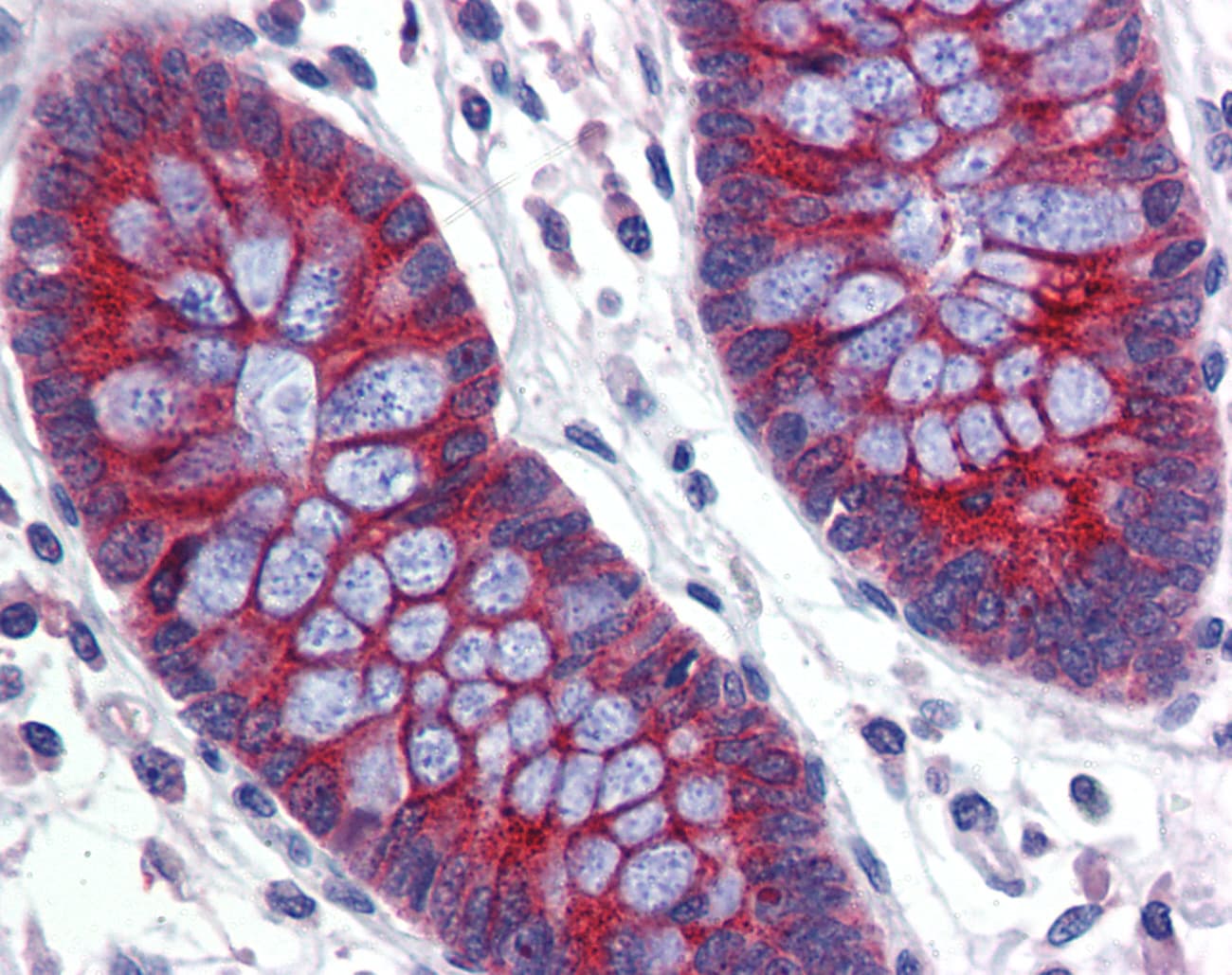 Polyclonal Rabbit anti-Human ABCA5 Antibody (aa1296-1345, IHC, WB)