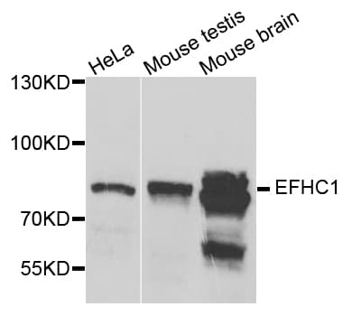 Polyclonal Rabbit anti-Human EFHC1 Antibody (IHC, WB)