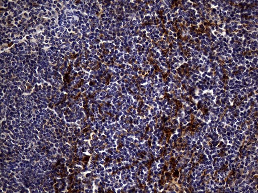 MME / CD10 Antibody (aa411-750, clone UMAB235)