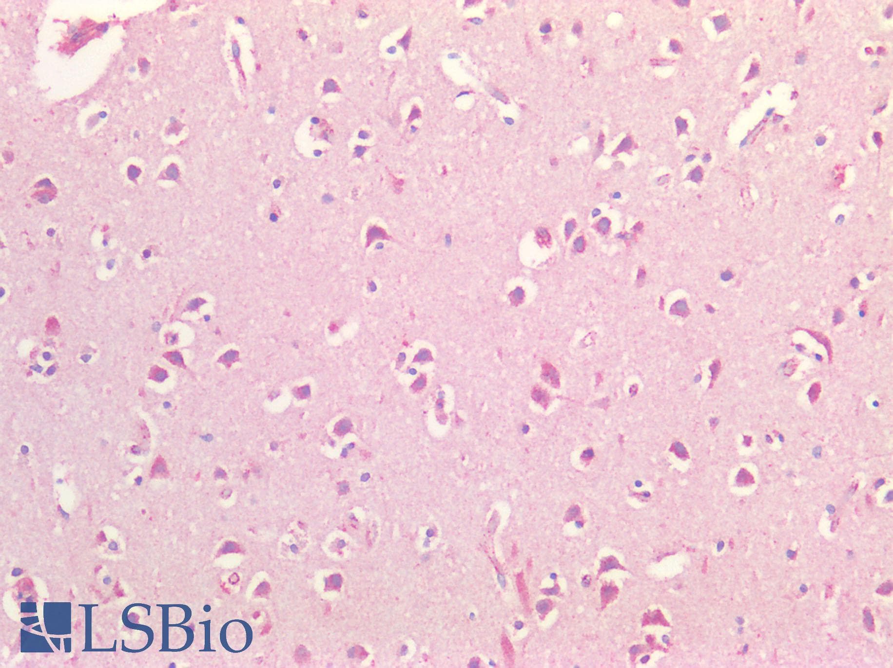 GCN2 Antibody (aa1-300)