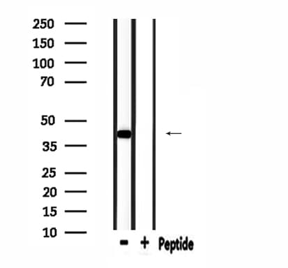 Polyclonal Rabbit anti-Human MRPL39 Antibody (IHC, IF, WB)