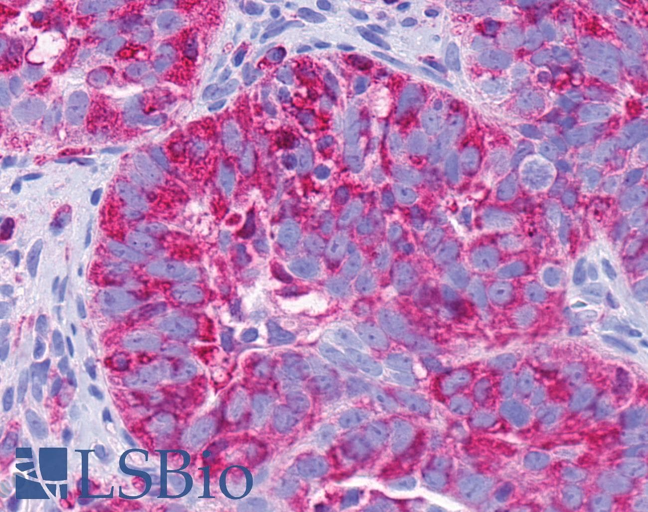 PathPlus™ Polyclonal Rabbit anti-Human GPR137B Antibody (C-Terminus, IHC)