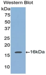 TNC / Tenascin C Antibody (aa49-181)