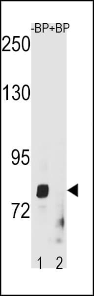 Polyclonal Rabbit anti-Human ZMAT1 Antibody (aa548-577, WB)