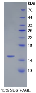 Mouse SRGN / Serglycin Protein (Recombinant His)