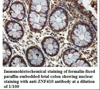 ZNF410 Antibody (aa49-244)