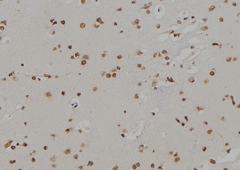 ALOX5 / 5-LOX Antibody