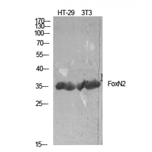 Polyclonal Rabbit anti-Human FOXN2 Antibody (310-390 aa, C-terminal, IHC, WB)