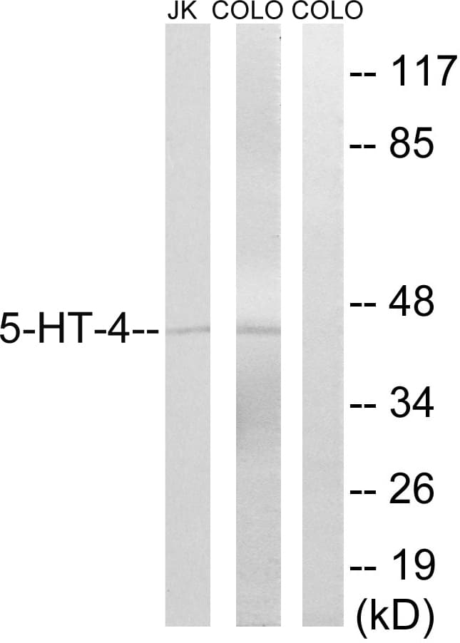 HTR4 / 5-HT4 Receptor Antibody (aa21-70)