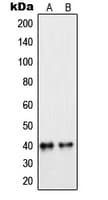 Polyclonal Rabbit anti-Human PEX7 Antibody (Internal, IHC, WB)
