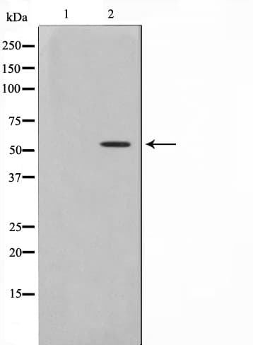 PKNOX2 Antibody