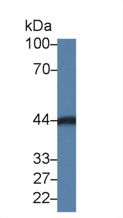 CA6 / Carbonic Anhydrase 6 Antibody (aa194-313)