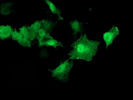 AKT1 Antibody (clone OTI4E10)