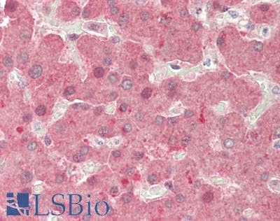 IHC-plus™ SERPIND1 / Heparin Cofactor 2 Antibody