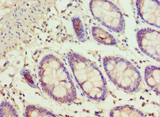 ADSS Antibody (aa1-280)