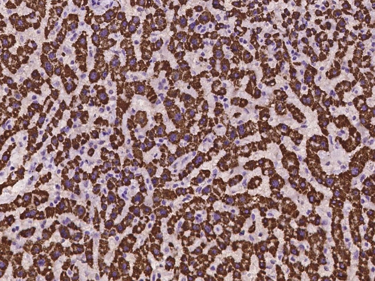 ECHDC2 Antibody