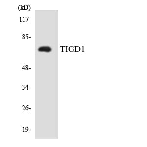 EEYORE / TIGD1 Antibody (aa243-292)