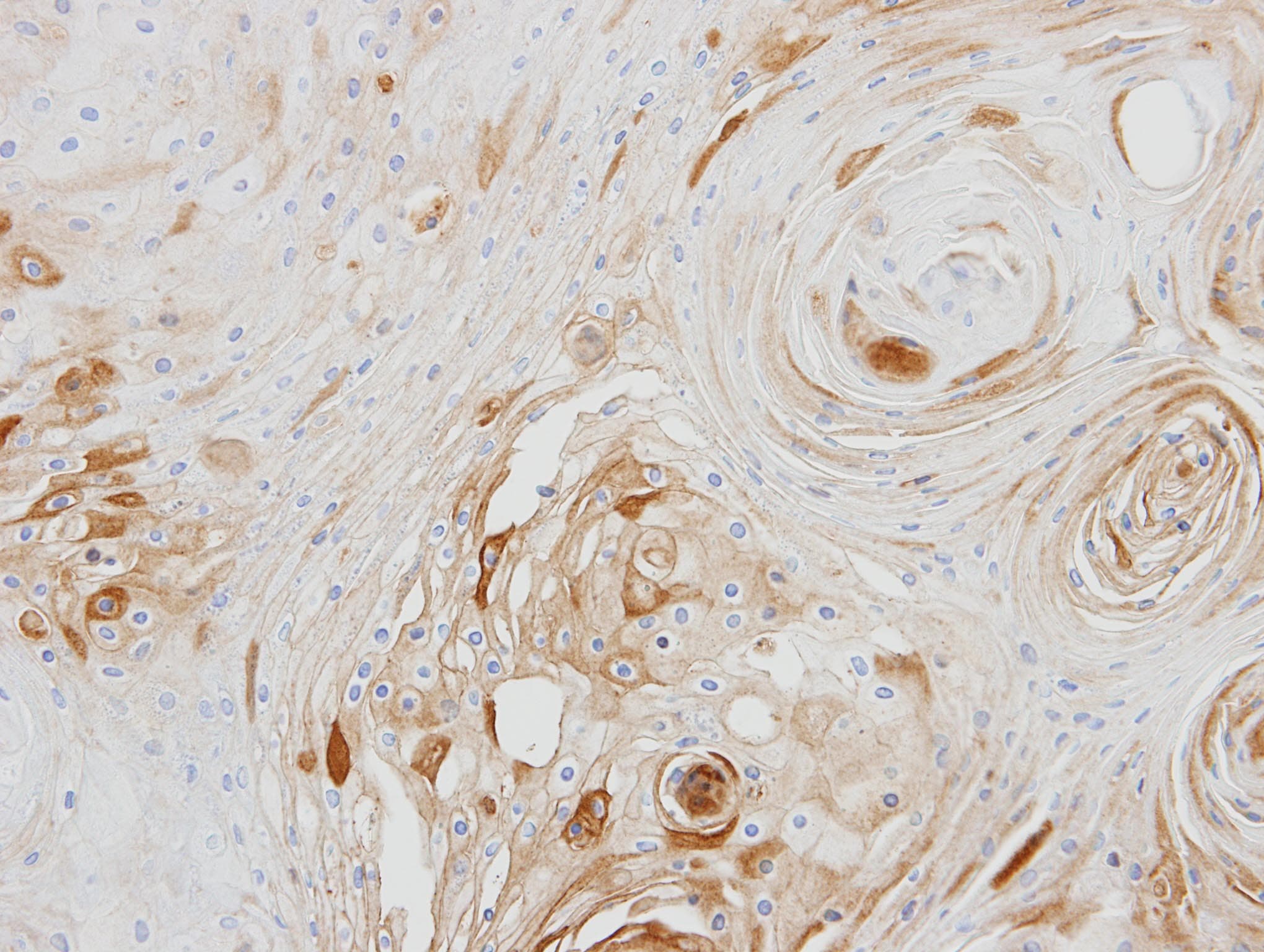 Polyclonal Rabbit anti-Human BCAT2 Antibody (aa1-332, IHC, WB)